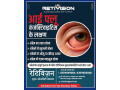 best-eye-flu-conjunctivitis-treatment-in-retivision-superspeciality-eye-centre-small-0
