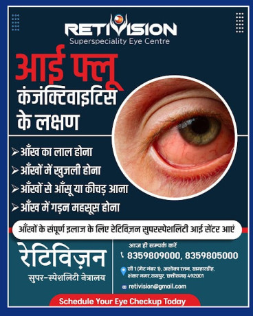 best-eye-flu-conjunctivitis-treatment-in-retivision-superspeciality-eye-centre-big-0